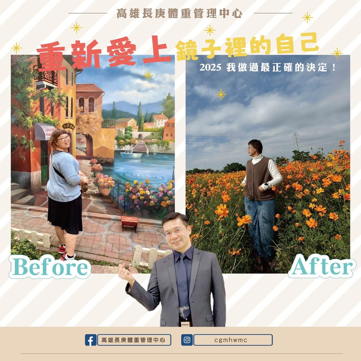 減重手術前後對比：重新愛上鏡子裡的自己