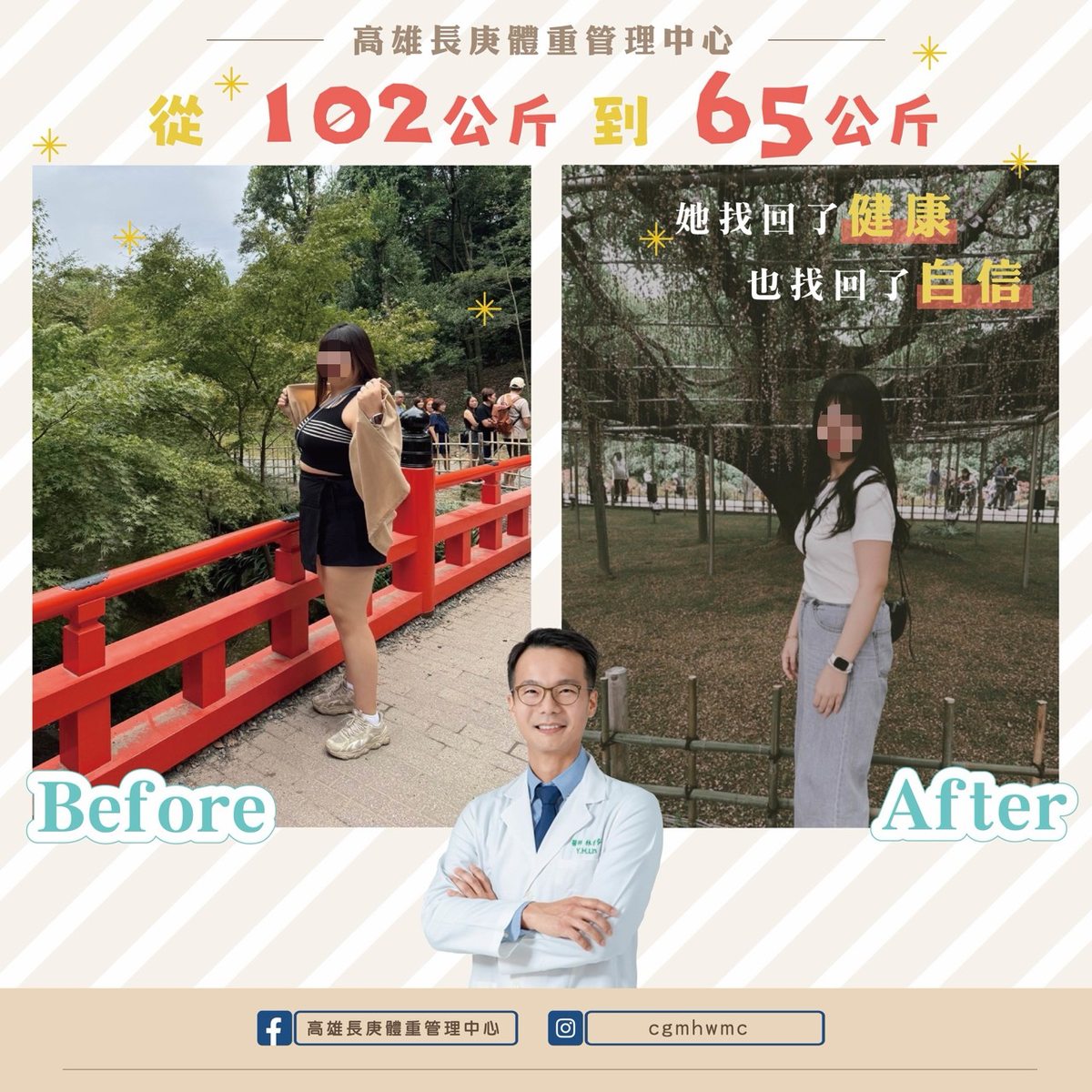 游泳教練媽媽SASI減重手術前後對比：從102公斤到65公斤，她找回了健康也找回了自信